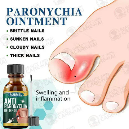 Anti Paronychia Relief Oil - (Buy 1 Get 1 FREE🔥)