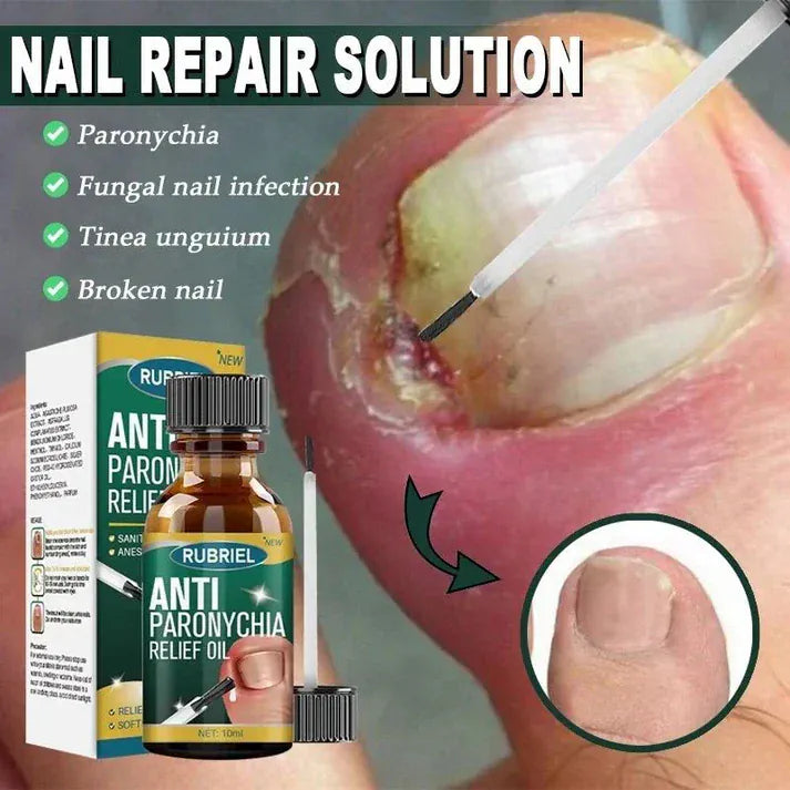 Anti Paronychia Relief Oil - (Buy 1 Get 1 FREE🔥)