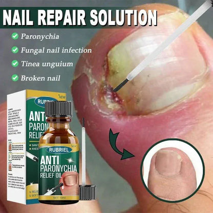 Anti Paronychia Relief Oil - (Buy 1 Get 1 FREE🔥)