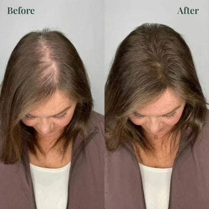 Kesaarose Rosemary Shampoo For Hair Growth (Buy 1 Get 1 Free 🔥🔥)