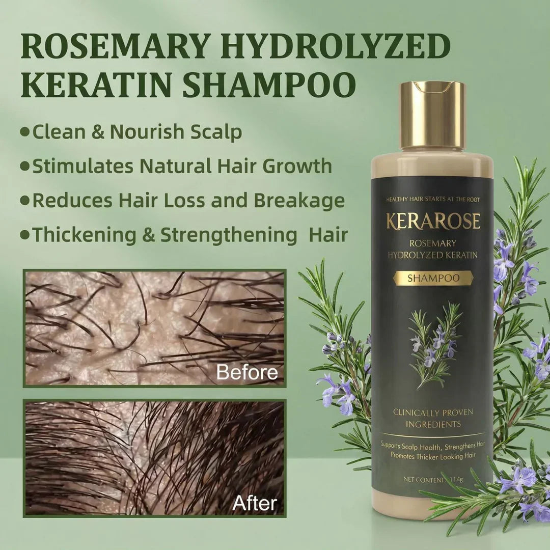 Kesaarose Rosemary Shampoo For Hair Growth (Buy 1 Get 1 Free 🔥🔥)