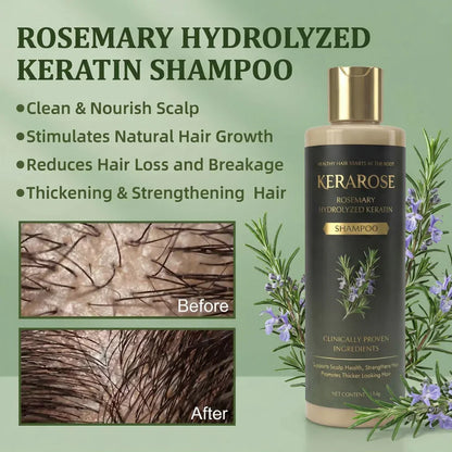Kesaarose Rosemary Shampoo For Hair Growth (Buy 1 Get 1 Free 🔥🔥)