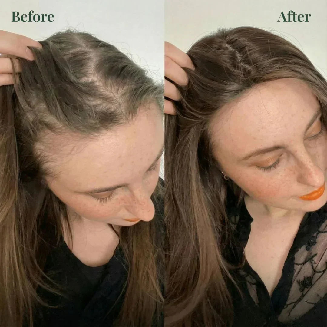 Kesaarose Rosemary Shampoo For Hair Growth (Buy 1 Get 1 Free 🔥🔥)