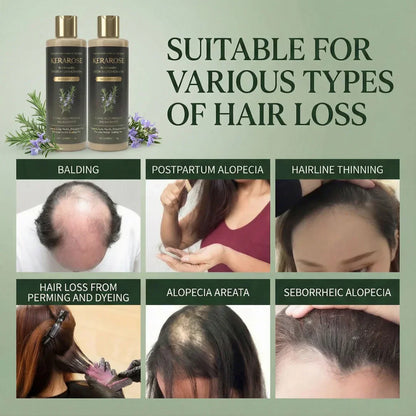 Kesaarose Rosemary Shampoo For Hair Growth (Buy 1 Get 1 Free 🔥🔥)